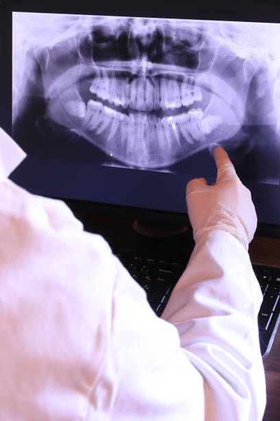 Best Emergency Gum Treatment in St Ansgar, IA