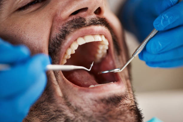 Best Urgent Care for Lost Fillings or Crowns in St Ansgar, IA