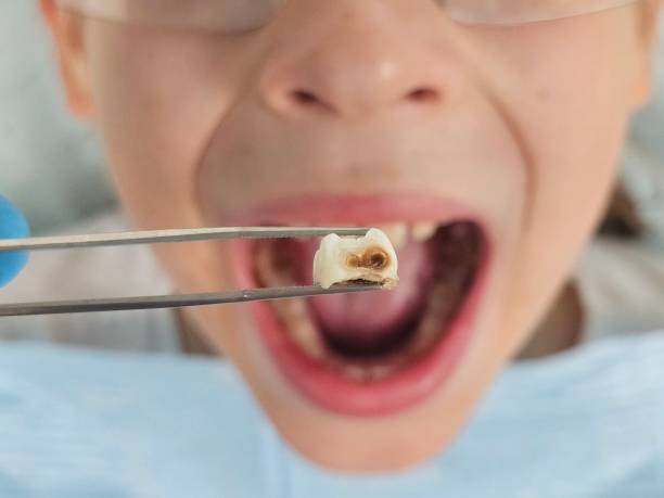 Best Same-Day Emergency Dental Services in St Ansgar, IA